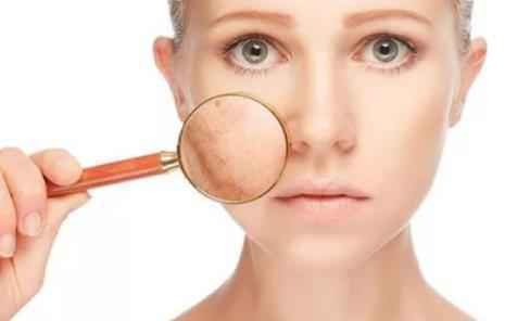 皮肤老化的现象和损坏的原因 皮肤的保健方法和预防措施