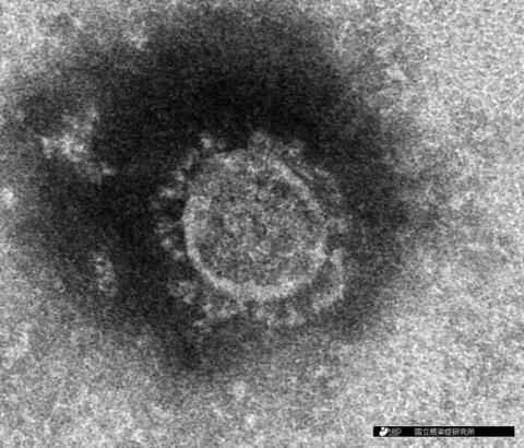 新冠病毒在电子显微镜下的照片（每日新闻）