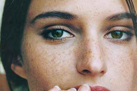 人脸上为什么会长斑 能够祛斑的食疗方法